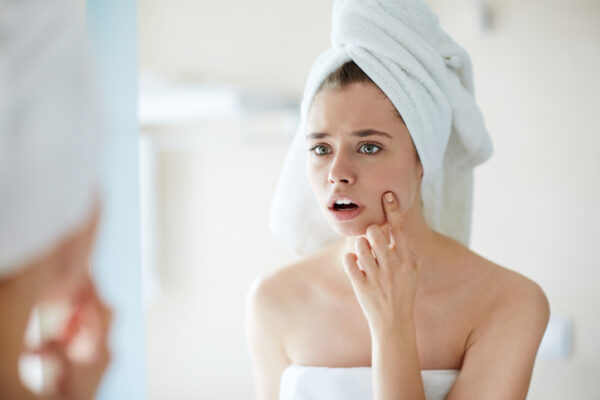 Different types of acne | How they are assessed and treated