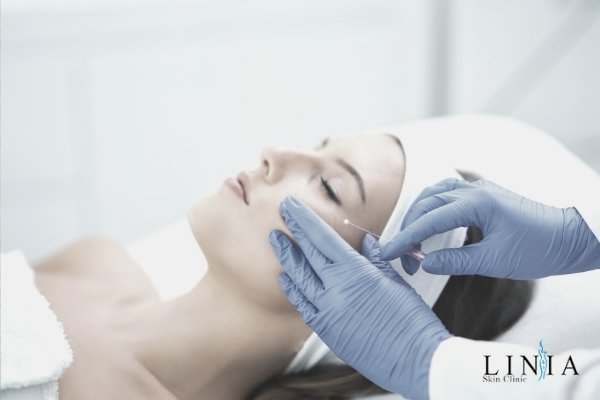 cost of a thread lift - woman getting thread lift under eye