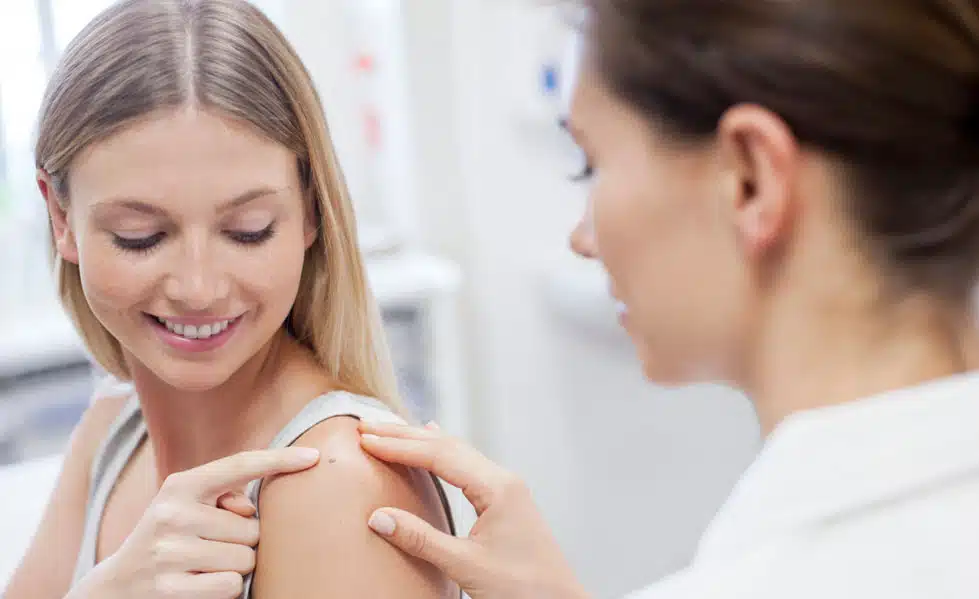 Is It Safe to Have Moles Removed? (Professionally or at Home)