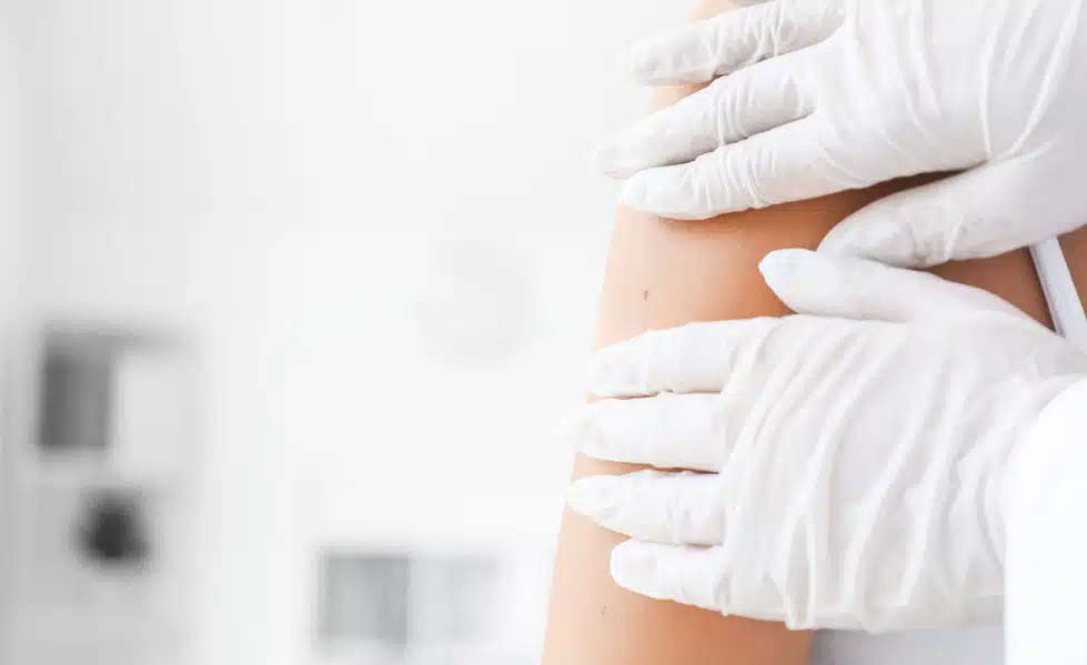 What to Expect After Mole Removal - Recovery Time & Aftercare