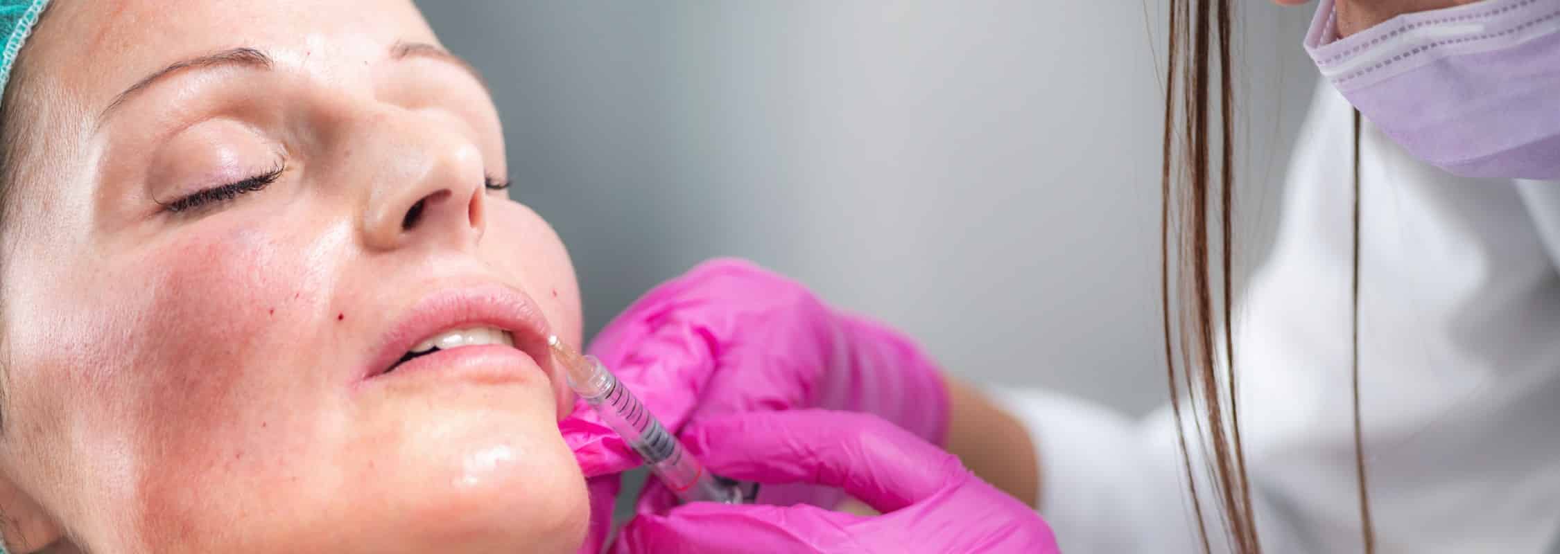 Dermal Fillers