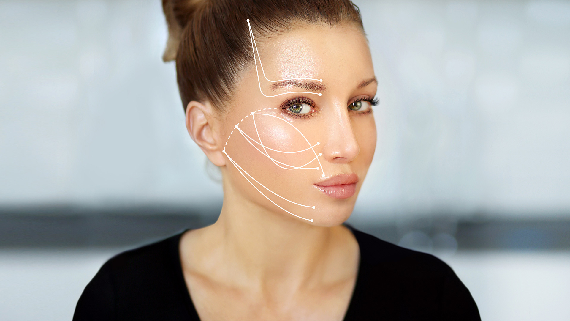 Neck Thread Lift