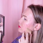 Find out how long Roaccutane takes to work and what results you can expect week by week