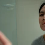 Understanding Why Acne Can Occur on Dry Skin and How to Treat It Effectively