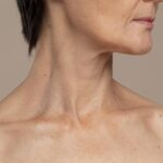 Side view of a woman's neck and collarbone, the area where neck cysts most often appear