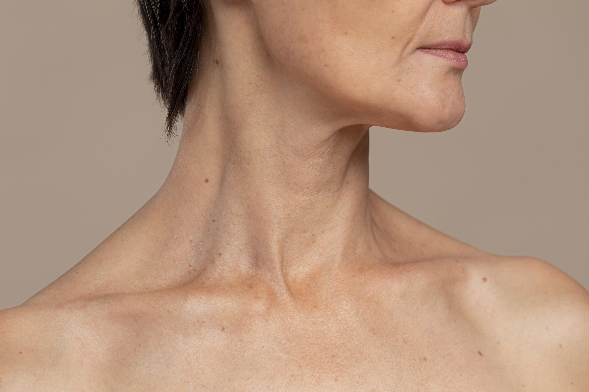 Side view of a woman's neck and collarbone, the area where neck cysts most often appear
